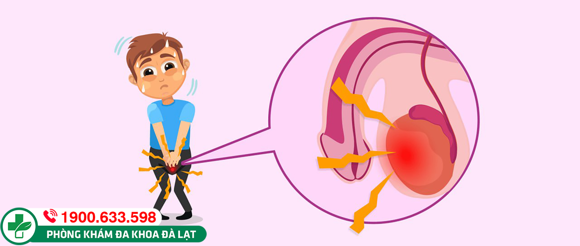 CHI PHÍ ĐIỀU TRỊ VIÊM TINH HOÀN