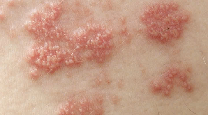 Block Image