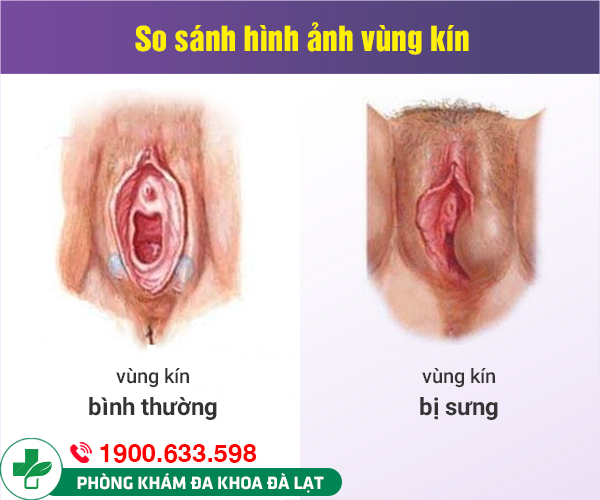 Block Image