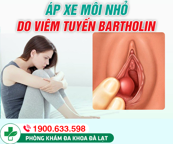 Áp xe môi nhỏ: Nguyên nhân và cách khắc phục