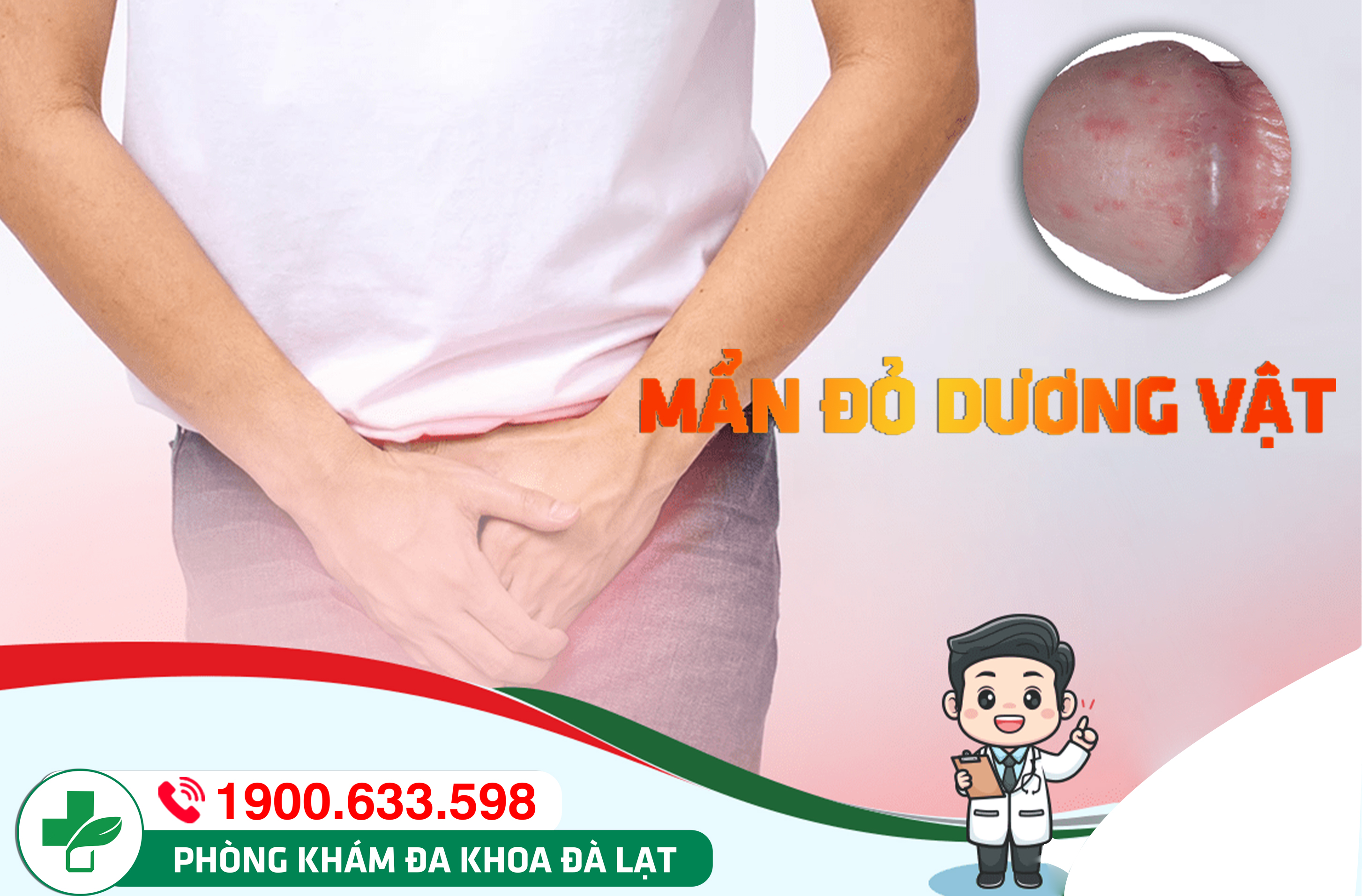 ĐỪNG CHỦ QUAN VỚI HIỆN TƯỢNG NỔI MẨN ĐỎ Ở BAO QUY ĐẦU