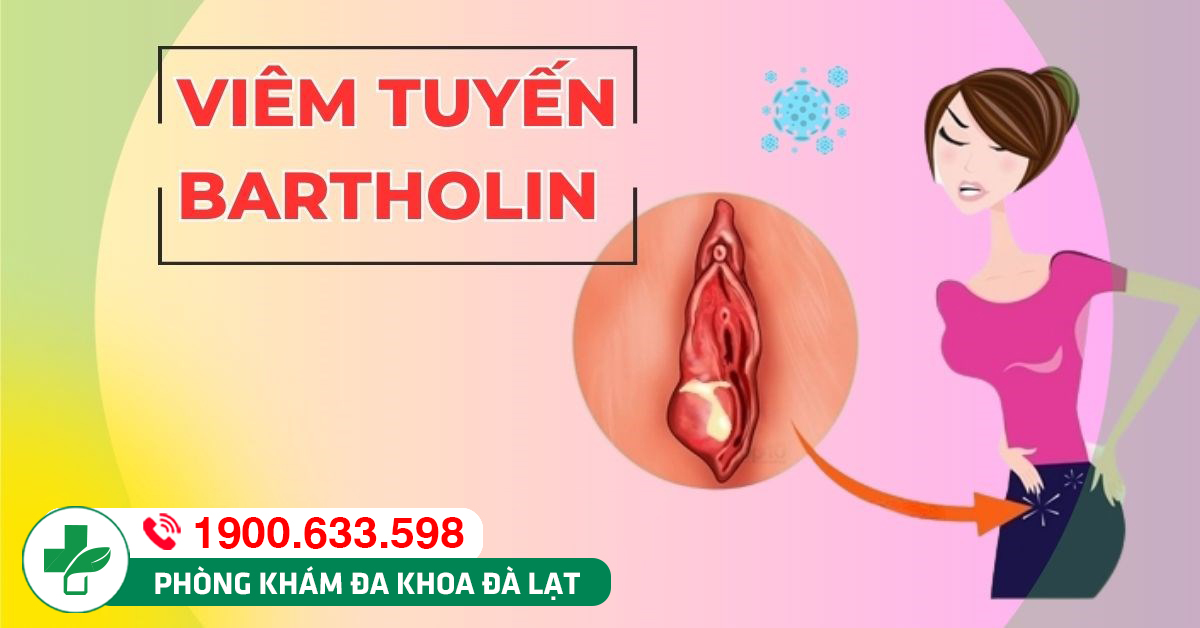 Áp Xe Vùng Kín – Nguyên Nhân, Triệu Chứng, Cách Điều Trị