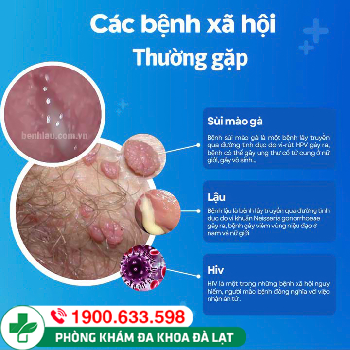 Bệnh xã hội là gì? Biểu hiện của bệnh xã hội