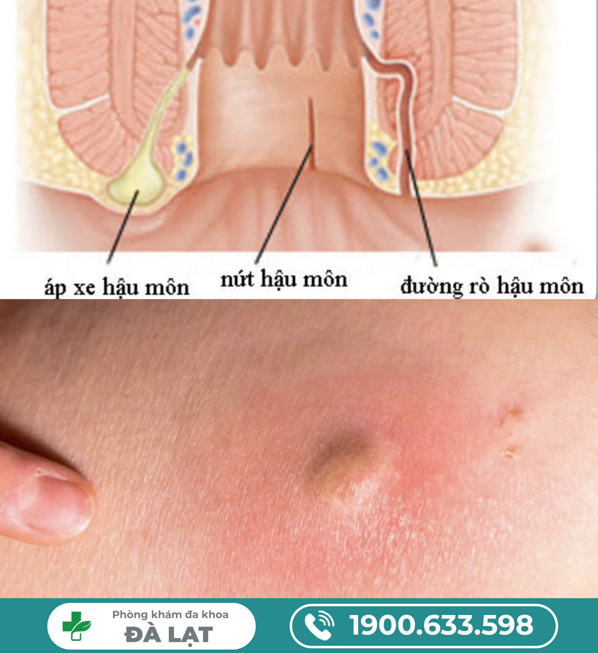Block Image