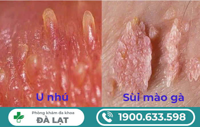 Block Image