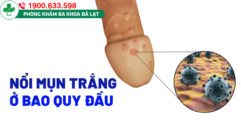 Block Image