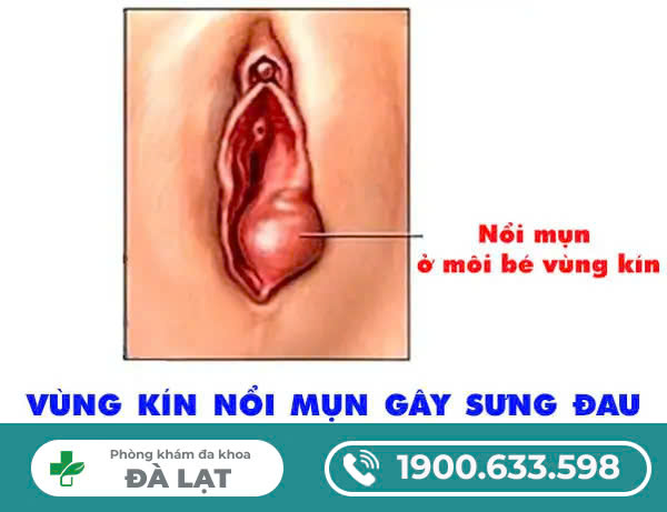 Block Image