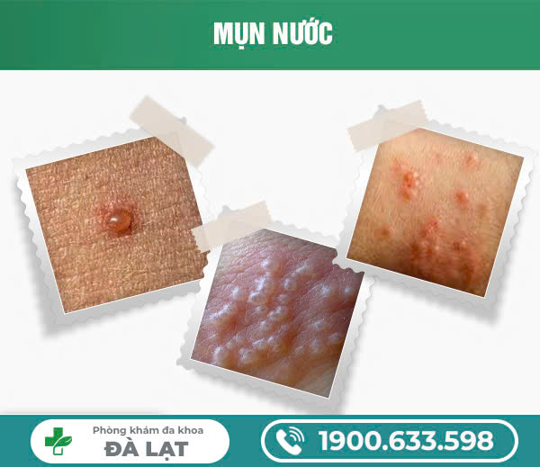 Block Image