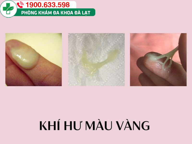 Block Image