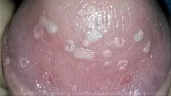 Block Image