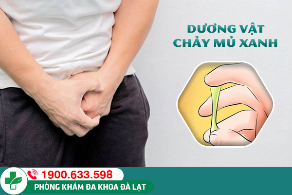 Dương vật chảy mủ xanh cảnh báo vấn đề sức khỏe sinh sản phái mạnh