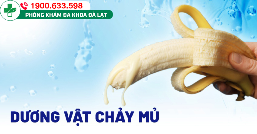 Hoang mang khi dương vật bị chảy mủ - nam giới cần xử trí ra sao?