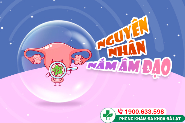 Nấm âm đạo: Nguyên nhân và phương pháp điều trị