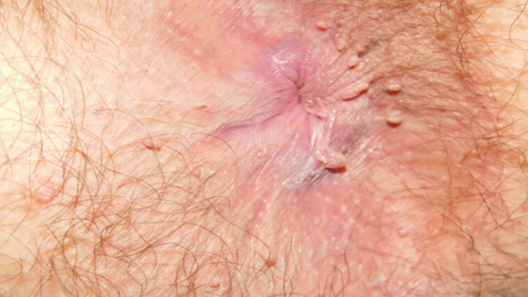 Block Image