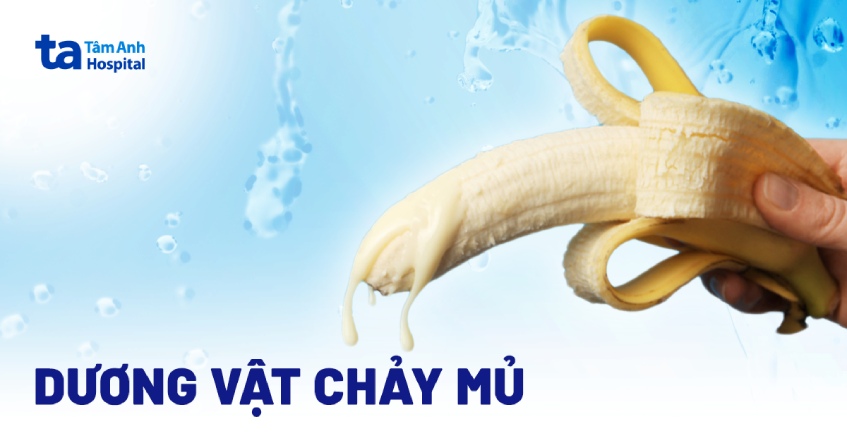 DƯƠNG VẬT ĐAU BUỐT CHẢY MỦ