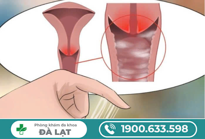 HÌNH ẢNH, BIỂU HIỆN CỦA VIÊM ÂM ĐẠO