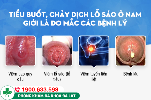 Lỗ sáo chảy mủ: Nguyên nhân và cách khắc phục