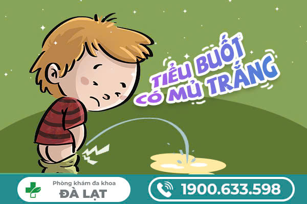 Cẩn trọng với dấu hiệu đi tiểu buốt có mủ trắng