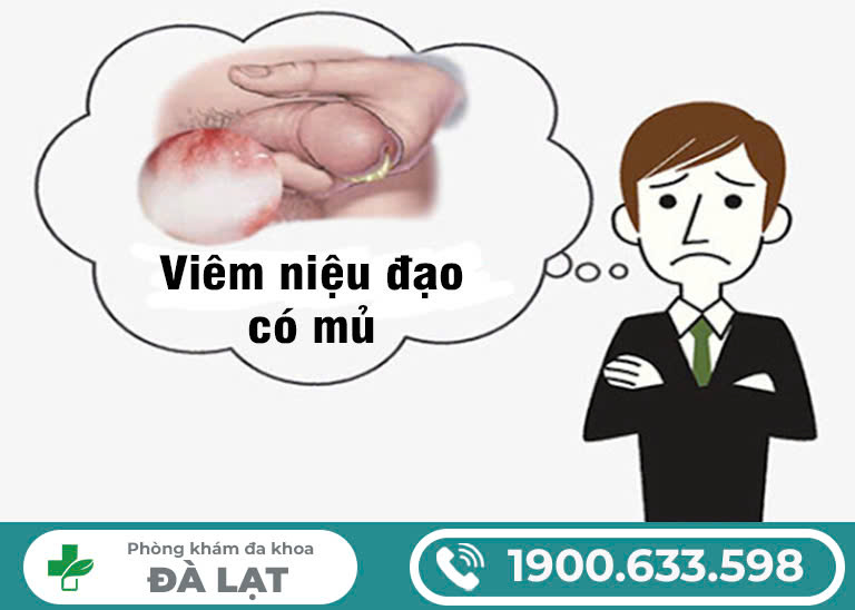 HHội chứng viêm niệu đạo có mủ do lậu : Nguyên nhân, triệu chứng và phương pháp điều trị