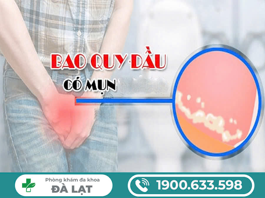 BAO QUY ĐẦU NỔI MẨN LÀ BỊ SAO? CÓ NGUY HIỂM KHÔNG?