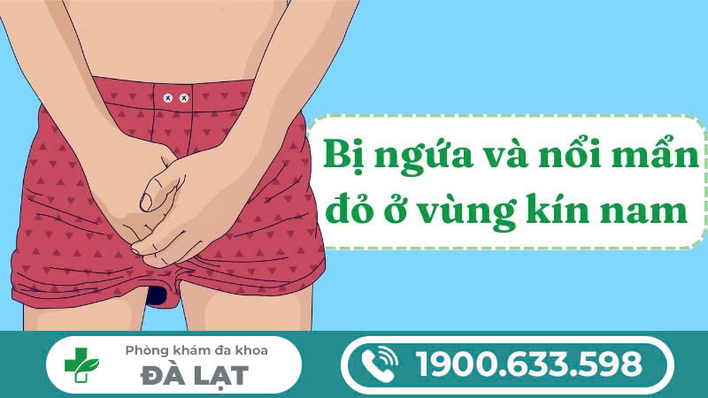 Nổi mẩn đỏ vùng kín nam: nguyên nhân và phương pháp điều trị