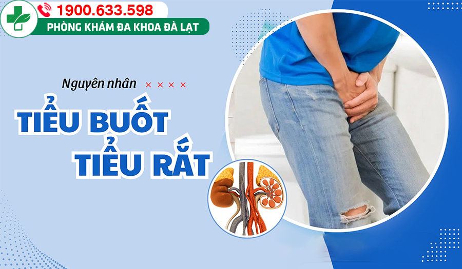 TỔNG QUÁT VỀ TIỂU BUỐT TIỂU RẮT 