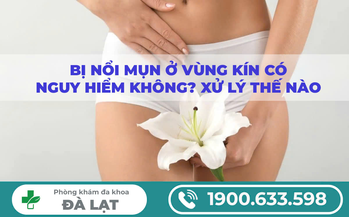 Mọc Mụn Ở Vùng Kín Có Nguy Hiểm Không? – Tư Vấn Và Điều Trị Tại Phòng Khám Đa Khoa Đà Lạt