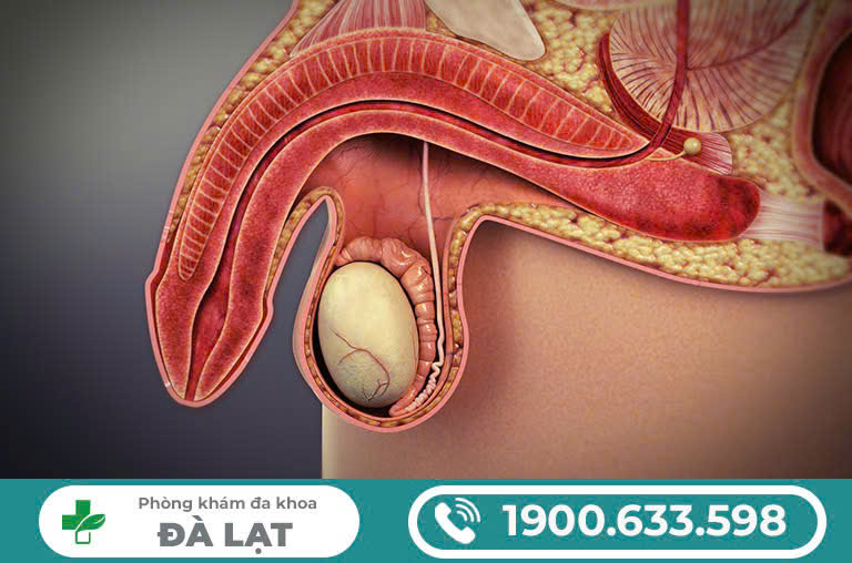 NGỨA ĐAU BÌU LÀ BỆNH GÌ? PHƯƠNG PHÁP ĐIỀU TRỊ HIỆU QUẢ NHẤT?