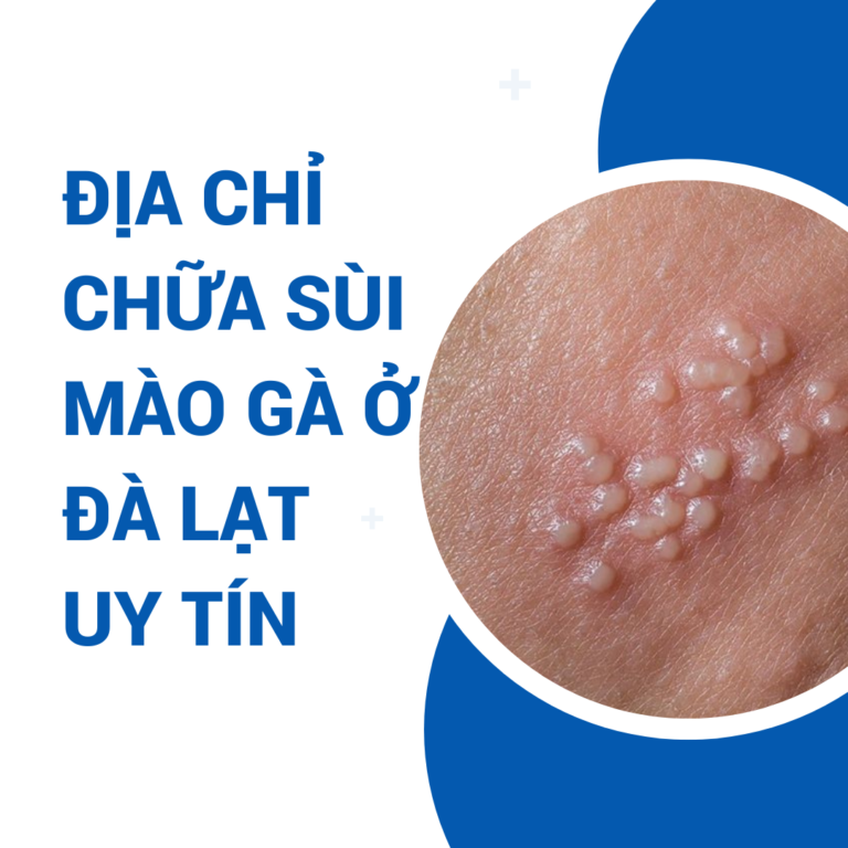 Phòng khám sùi mào gà uy tín?