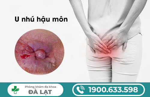 U NHÚ HẬU MÔN