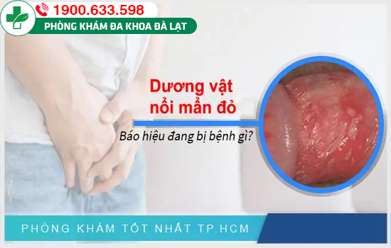 Dương vật nổi mụn đỏ 