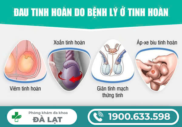 CÁCH CHỮA ĐAU TINH HOÀN