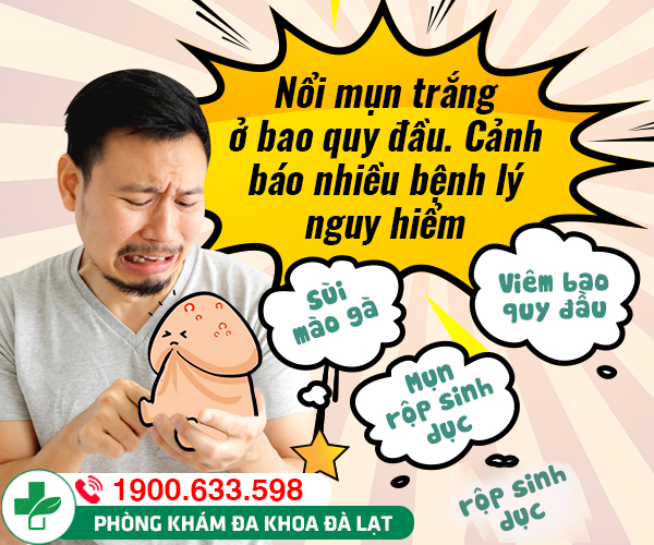 Mụn trắng ở bao quy đầu có sao không? Phương pháp điều trị hiệu quả