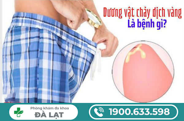 Dương vật chảy mủ – Cảnh báo bệnh lý nguy hiểm ở nam giới