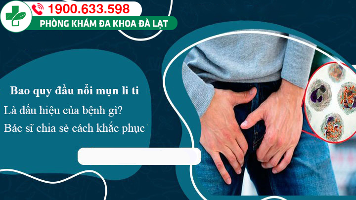 Tại sao mọc mụn li ti bao quy đầu? 4 bệnh lý cần đề phòng