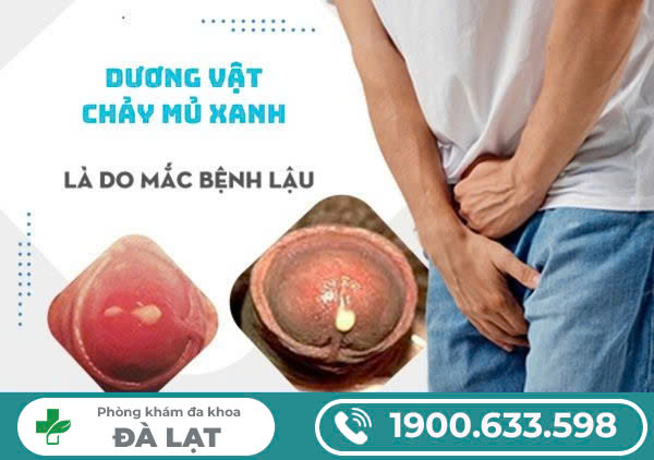 Dương vật tiết mủ xanh, dấu hiệu không được bỏ qua
