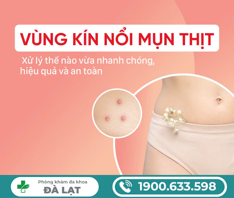 Âm đạo nổi mụn thịt là bị làm sao? Cách chữa trị