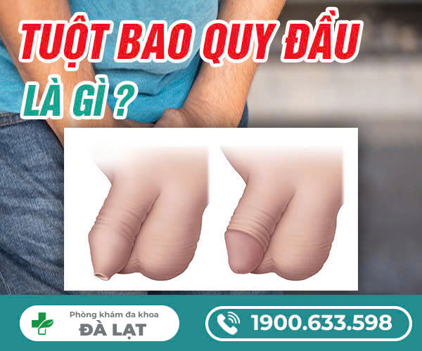 TUỘT BAO QUY ĐẦU LÀ GÌ?