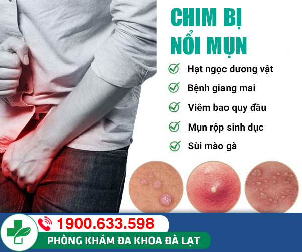 Nguyên nhân dương vật nổi mụn, cách điều trị hiệu quả
