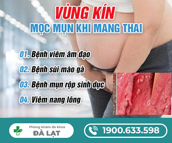 Mọc mụn ở vùng kín khi mang thai