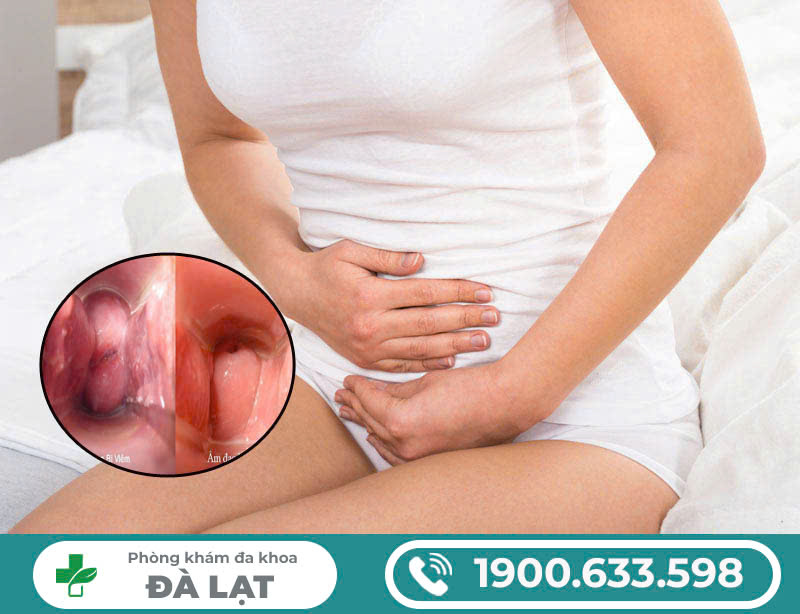 MỌC MỤN CÓ MỦ Ở HỘT LE