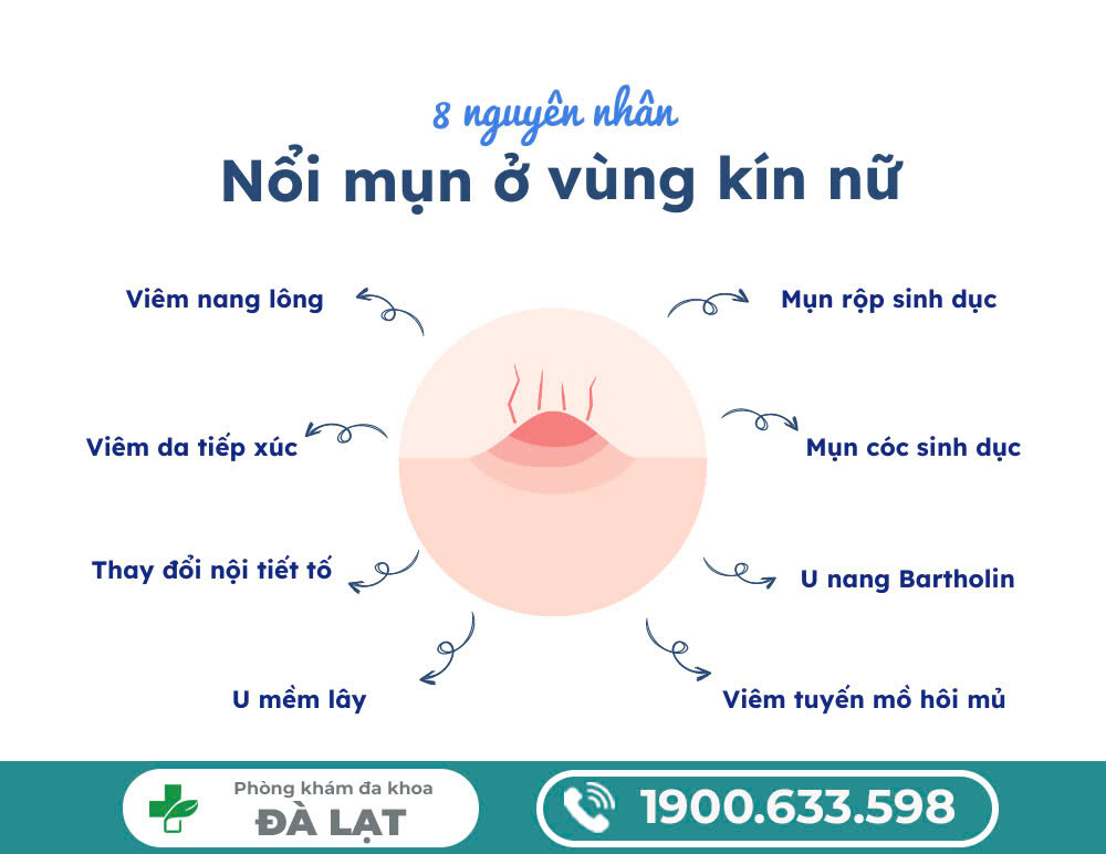 NGUYÊN NHÂN MỌC MỤN VÙNG KÍN 