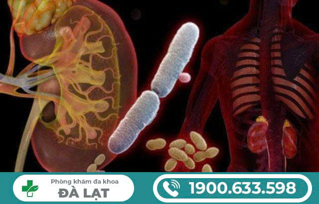 VIÊM BÀNG QUANG KẼ VÀ DIỆN CHẨN: HIỂU ĐÚNG ĐỂ ĐIỀU TRỊ HIỆU QUẢ