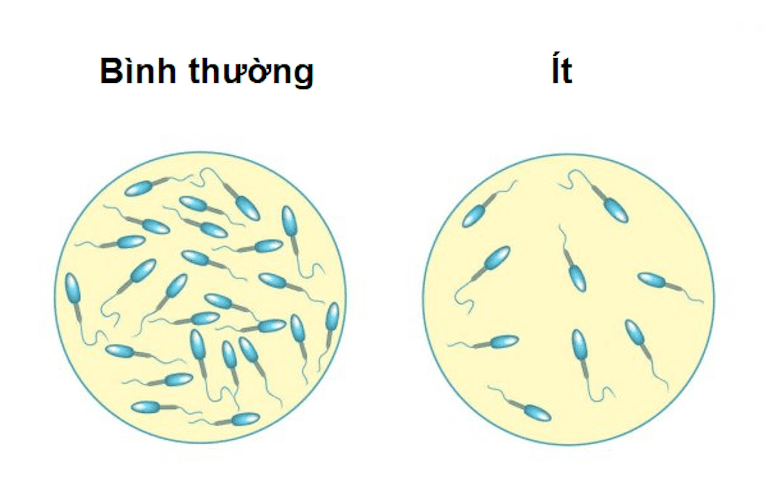 TINH TRÙNG ÍT LÀ NHƯ THẾ NÀO VÀ PHƯƠNG PHÁP ĐIỀU TRỊ