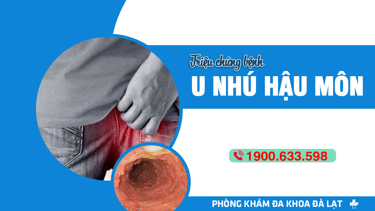 U NHÚ HẬU MÔN: TRIỆU CHỨNG VÀ PHƯƠNG PHÁP ĐIỀU TRỊ