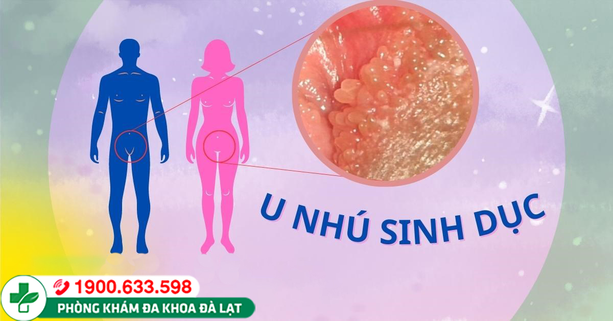 U NHÚ SINH DỤC Ở NAM VÀ NỮ GIỚI
