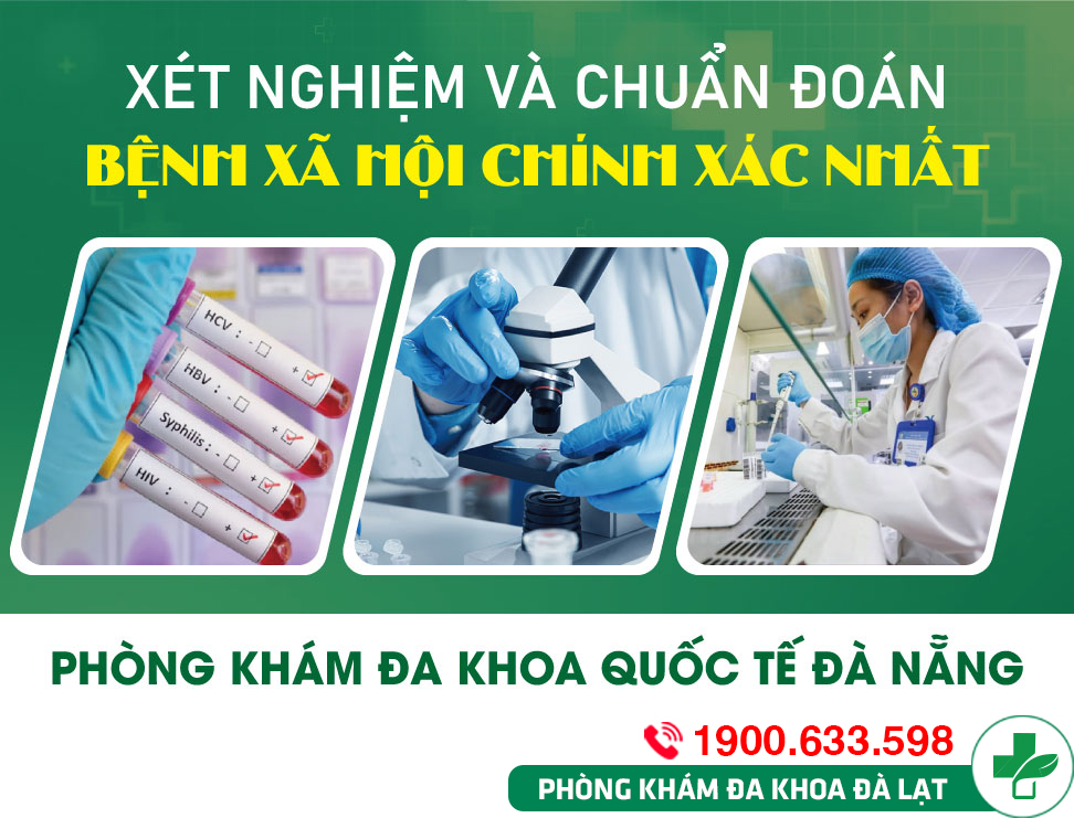 Xét nghiệm bệnh xã hội: Vai trò và phương pháp thực hiện