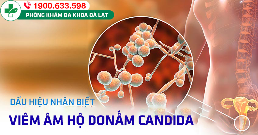 Viêm âm hộ do nấm Candida vùng kín: Nguyên nhân, triệu chứng