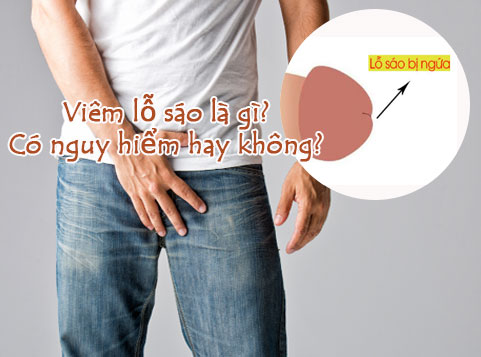 VIÊM LỖ SÁO: NGUYÊN NHÂN, TRIỆU CHỨNG, PHƯƠNG PHÁP ĐIỀU TRỊ HIỆU QUẢ TẠI PHÒNG KHÁM ĐA KHOA ĐÀ LẠT
