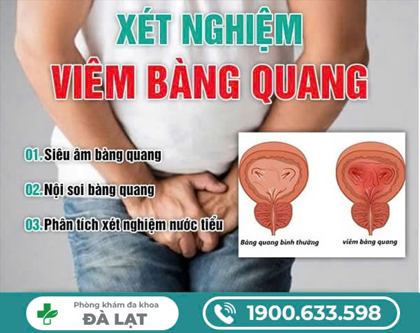 XÉT NGHIỆM VIÊM BÀNG QUANG NHƯ THẾ NÀO?